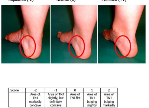 what is the foot posture index used for